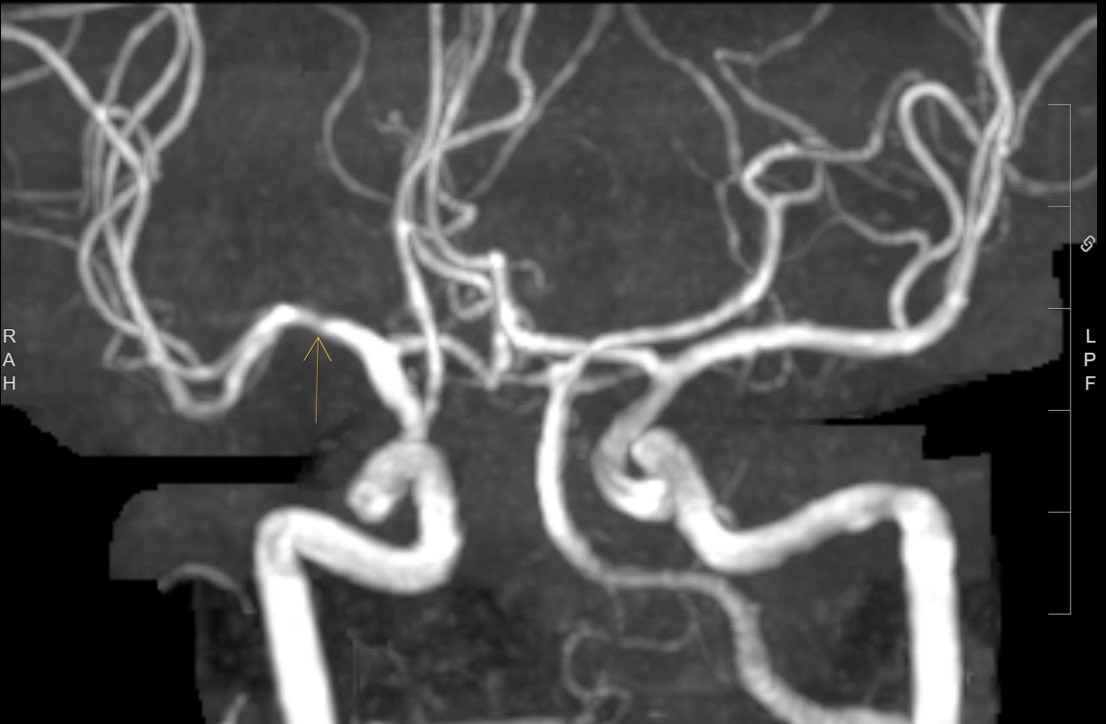 Francis Deng, MD tweet media