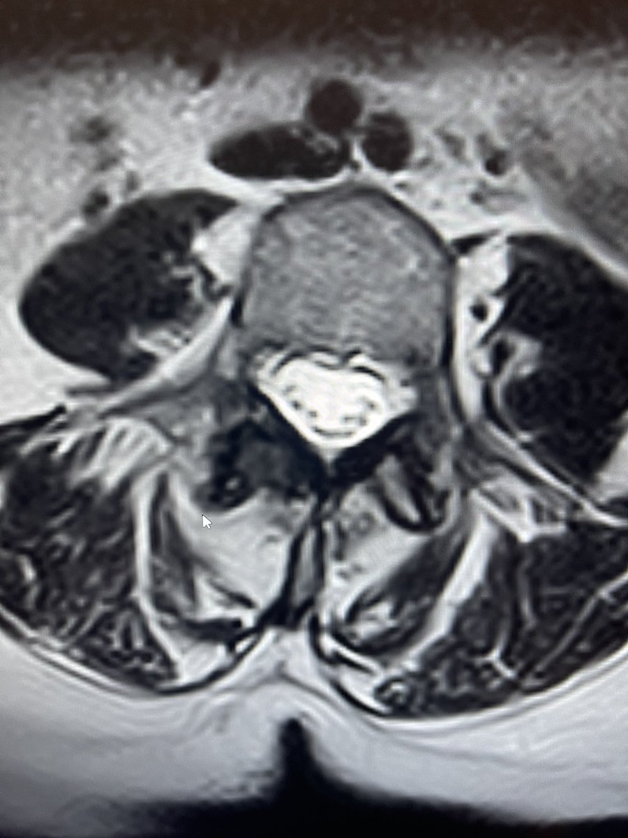 Glade Roper, MD - MSK/IR tweet media