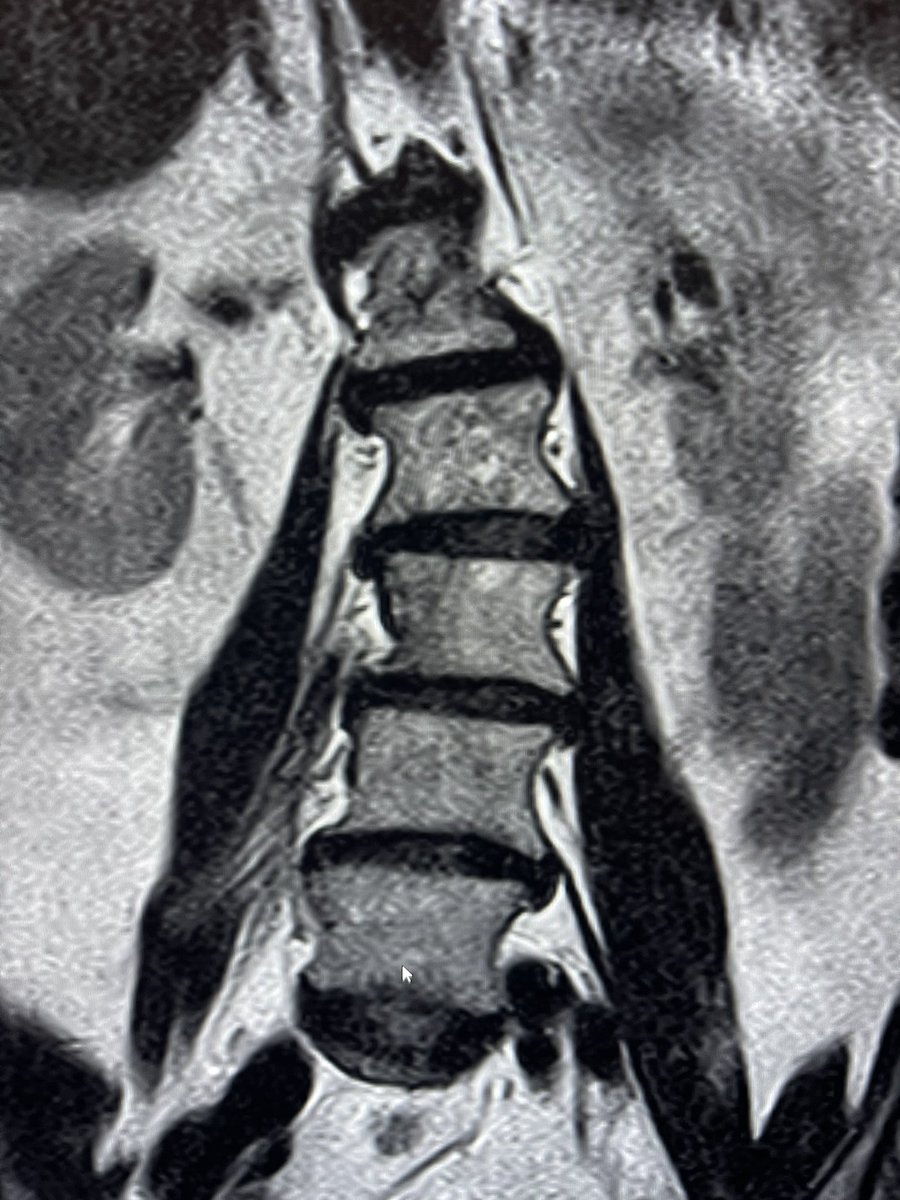 Glade Roper, MD - MSK/IR tweet media