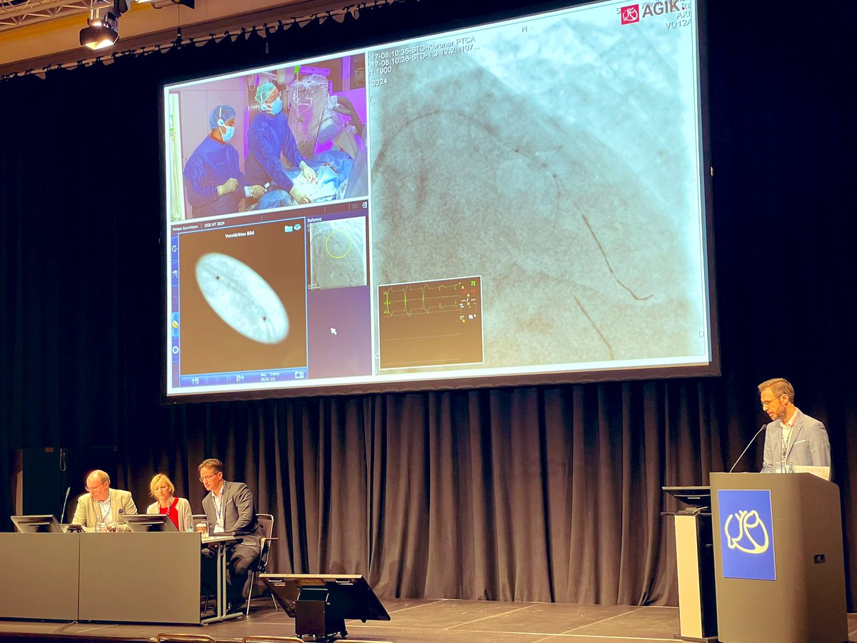 Tilman Schneider (@tschneidermd) on Twitter photo Die kalzifizierte Läsion mit <a href="/KardiologieHH/">Erik Rafflenbeul</a> und einem IVL-Case Live in a Box.
Panel: <a href="/sinning_jan/">Jan-Malte Sinning</a>, M. Lutz, M. Knorr Die kalzifizierte Läsion mit <a href="/KardiologieHH/">Erik Rafflenbeul</a> und einem IVL-Case Live in a Box.
Panel: <a href="/sinning_jan/">Jan-Malte Sinning</a>, M. Lutz, M. Knorr
