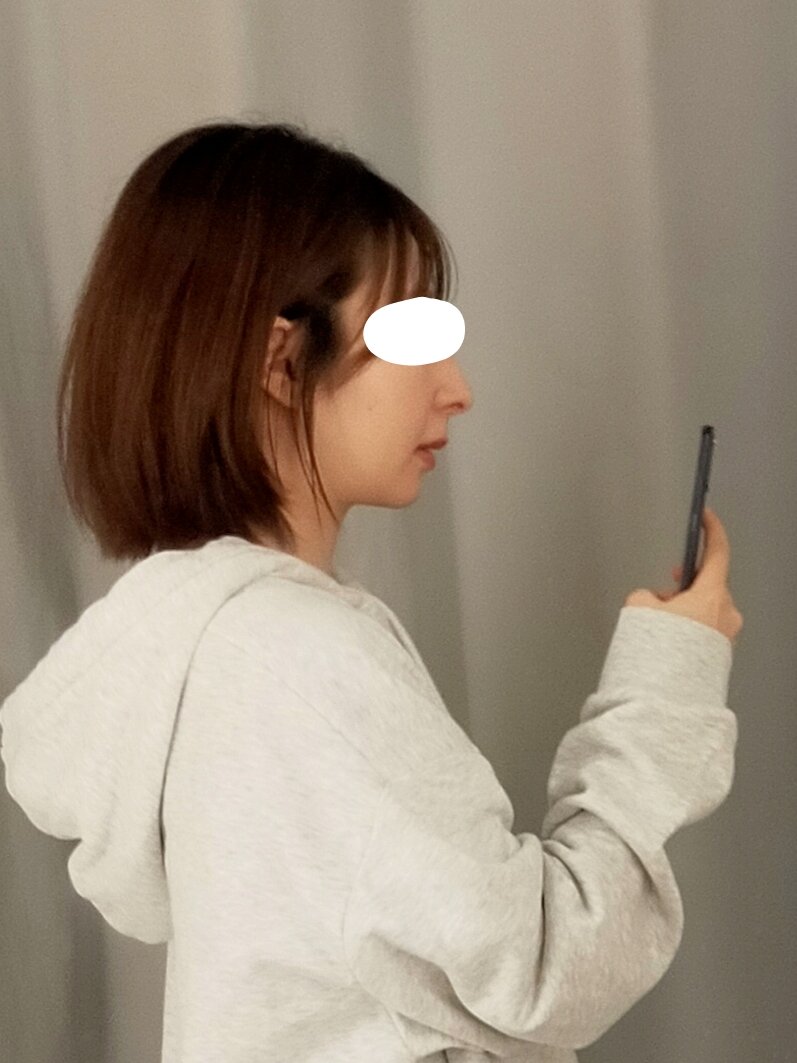 全然載せてなかったから久しぶりの投稿！鏡に映った横顔 
二重あごにならないのがいい

でも私の顔って中顔面が前に出てて(鼻柱基部・鼻翼基部が高すぎじゃない？)鳥みたいな骨格(鳥顔って呼んでる)だからなんか特殊で、そこの立体感落ち着いたらバランスいいと思うんだけどなぁ