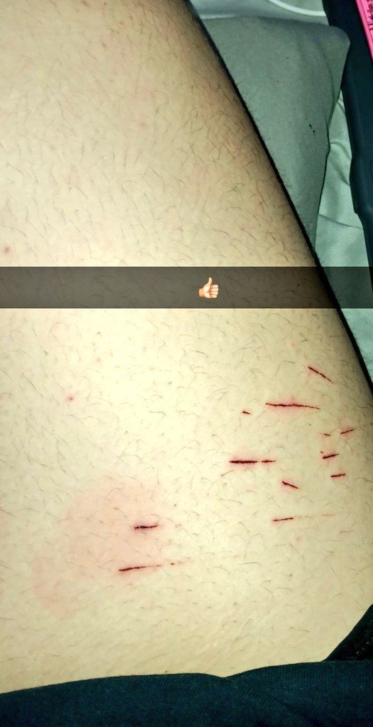 ASHRAWRXD's tweet photo. How did my thigh went from this, DO THAT?! #shtwtᅠ https://t.co/CW19mTiVCL
