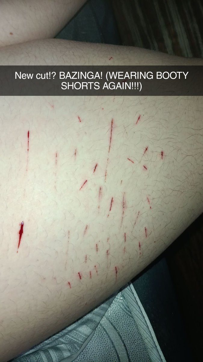 ASHRAWRXD's tweet photo. How did my thigh went from this, DO THAT?! #shtwtᅠ https://t.co/CW19mTiVCL