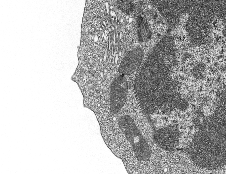 A new study in <a href="/SciImmunology/">Science Immunology</a> suggests that moderate #fevers impair electron transport chain complex 1 function and drive mitochondrial damage in T helper 1 cells.

📄: scim.ag/8oc