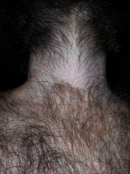 goonsmokers's tweet photo. Extreme neck fur https://t.co/5b1qTeAXYA