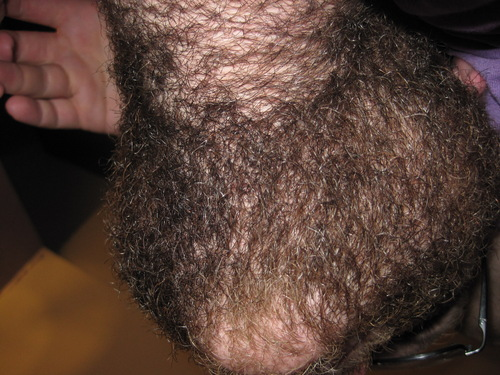 goonsmokers's tweet photo. Extreme neck fur https://t.co/5b1qTeAXYA