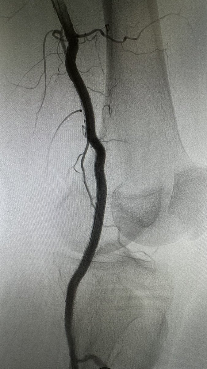 Igor Rafael Sincos, MD, PhD, MBA tweet media