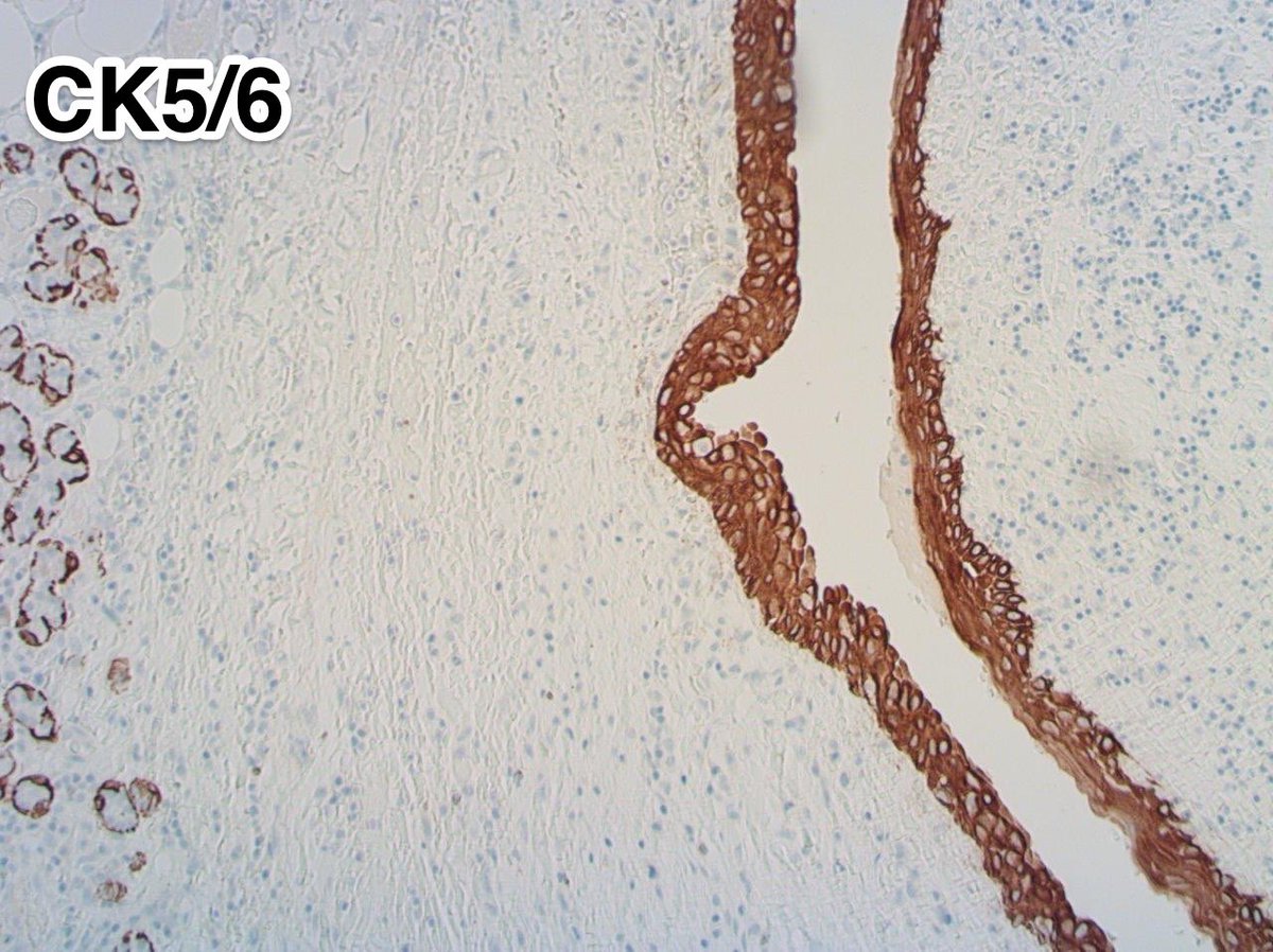 Tim Bracey tweet media