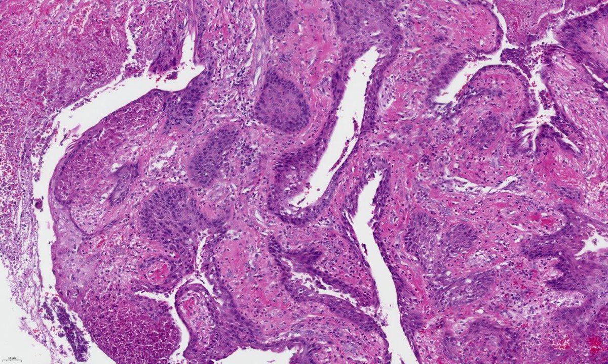 Tim Bracey tweet media