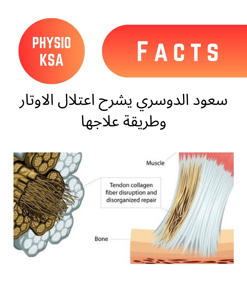 physio_ksa's tweet photo. سعود الدوسري يشرح اعتلال الاوتار وطريقة علاجها

@Sa_hx2 
#فزيو_السعودية #علاج_طبيعي https://t.co/eQyUqJxA9h