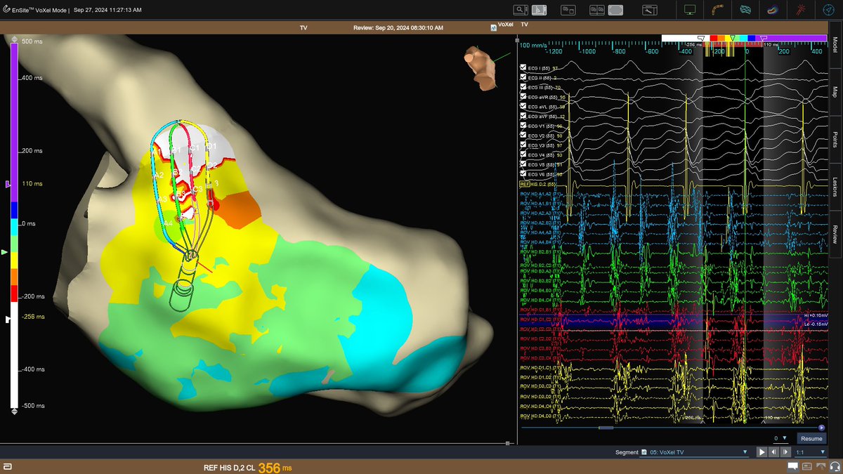 Ivo Roca, FEHRA, FESC tweet media