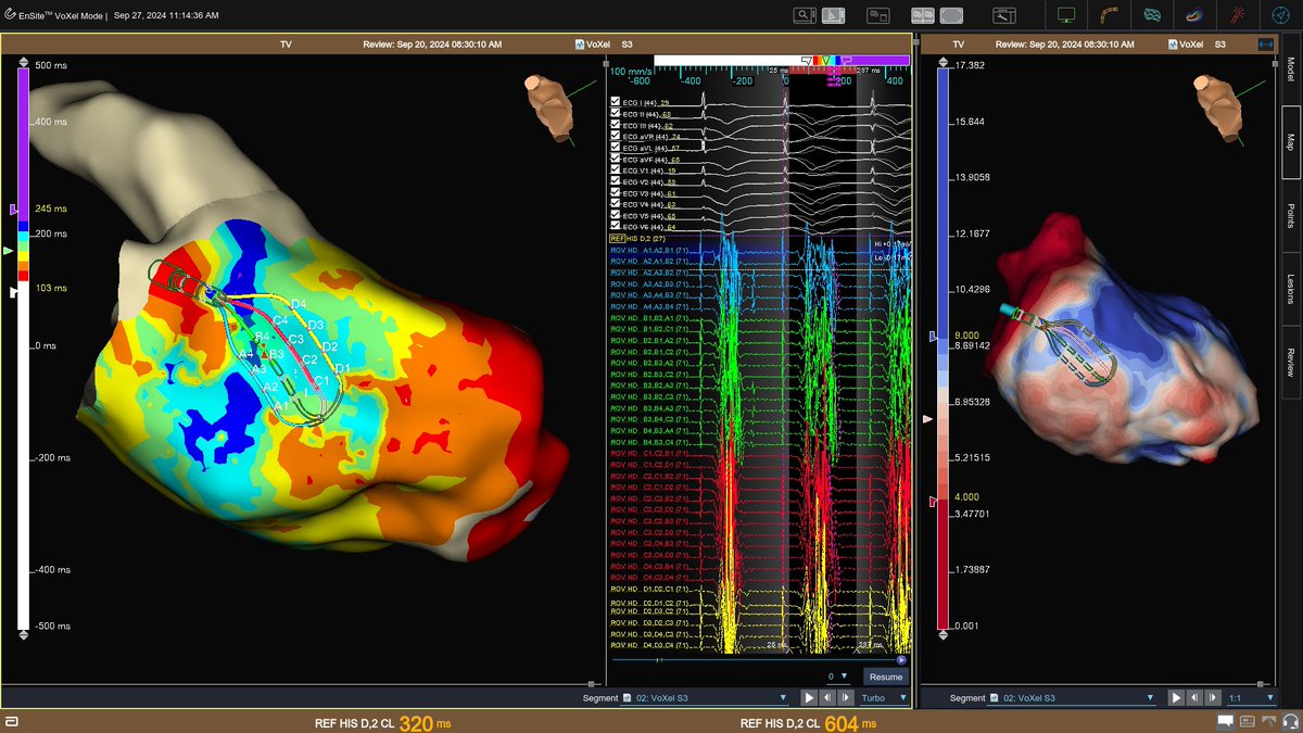 Ivo Roca, FEHRA, FESC tweet media