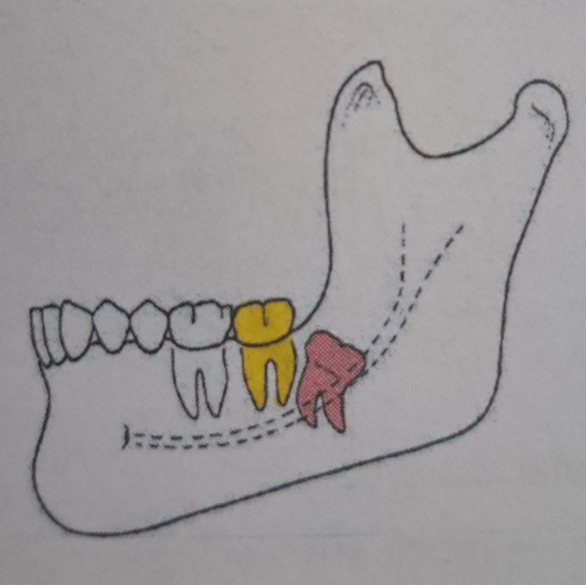 position of the day: distoanguler