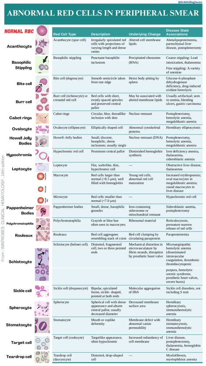 DrAkhilX's tweet image. 🌟RBC morphology abnormalities in a peripheral blood smear - A list👇