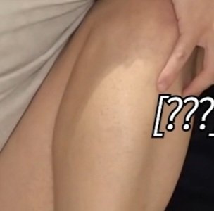 제모의 흔적... 자라나라 다리다리