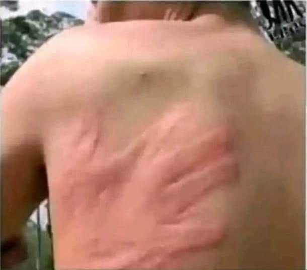 When a colleague that is swapo fan asks me to kill a mosquito on his  back😒