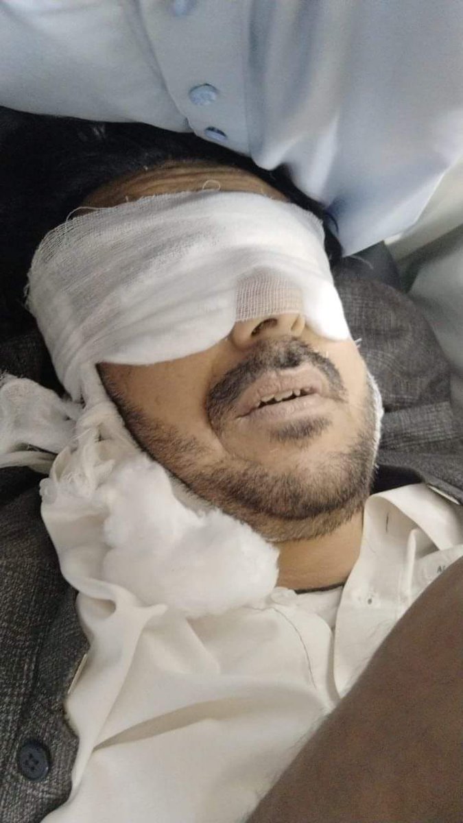 AdvfaridaBaloch's tweet photo. بلوچستان نیشنل پارٹی کے سینٹرل ایگزیکٹو کمیٹی کے ممبر  آغا خالد شاہ کی شہادت بلوچستان کے سیاست کے لیے نا قابل تلافی نقصان ہے 
@sakhtarmengal 
@officialbnp1 https://t.co/75Z5G7suMR