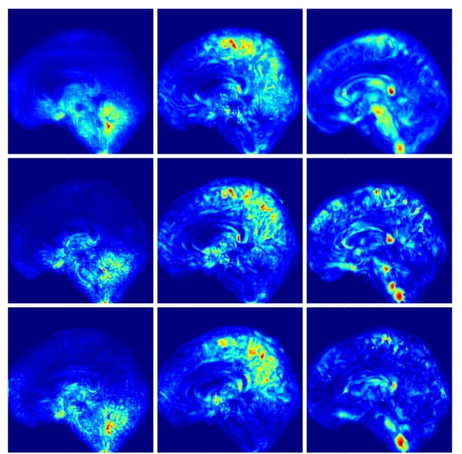 This Sunday September 29th our great PhD student @JordiMalCarbone from <a href="/LaSalleBCN/">La Salle BCN</a> will be presenting his work "Towards the Discovery of Down Syndrome Brain Biomarkers Using Generative Models" at the Bioimage Computing workshop <a href="/eccvconf/">European Conference on Computer Vision #ECCV2026</a> poster session