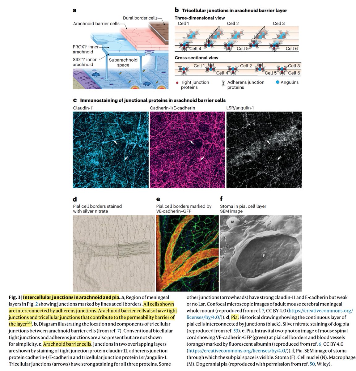 westr's tweet photo. Advances and controversies in #meningeal biology:
https://t.co/BjTVmQjfuV
@SiegenthalerLab @NatureNeuro
#dura #arachnoid #CSF #glymphatics #fibroblast #tightjunctions
Epic review of the current detailed landscape of #brain #meninges structure, function, and pathophysiology.
Clinical investigation of #neuroinflammatory and #neurodegeneration conditions, including #arachnoiditis, #leptomeningitis, #chronicmeningitis, and other diseases of the #leptomeninges, as well as many other brain and #spinalcord diseases, should begin here.