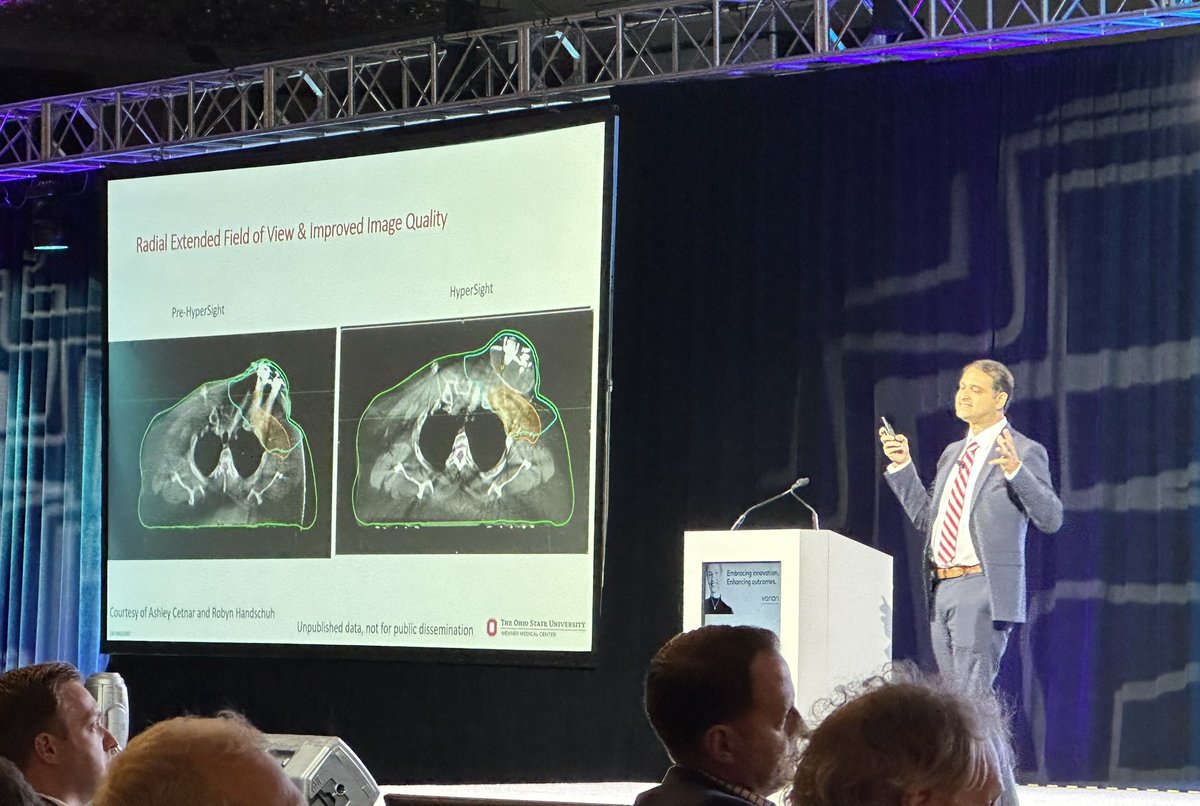 Robyn Handschuh (@handschuhcal) on Twitter photo Kicking off #ASTRO24 catching <a href="/SujithBaliga/">Sujith Baliga</a> highlight the clinical benefits we have seen <a href="/OhioStateRadOnc/">OhioStateRadOnc</a> using HyperSight imaging on TrueBeam Kicking off #ASTRO24 catching <a href="/SujithBaliga/">Sujith Baliga</a> highlight the clinical benefits we have seen <a href="/OhioStateRadOnc/">OhioStateRadOnc</a> using HyperSight imaging on TrueBeam