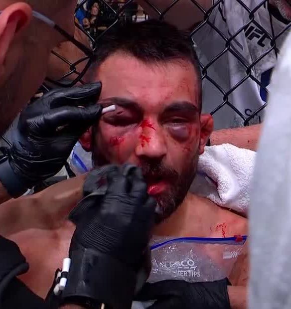 nyweqq's tweet photo. #UFCParis https://t.co/LLXc2VEmbJ