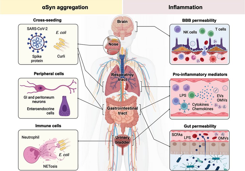 The Science of Parkinson's (@scienceofpd) on Twitter photo I'm such a sucker for reviews on infections in the etiology of #Parkinsons
Thank you <a href="/peelaerts_w/">Wouter Peelaerts</a> & team - this is my weekend reading
content.iospress.com/articles/journ… I'm such a sucker for reviews on infections in the etiology of #Parkinsons
Thank you <a href="/peelaerts_w/">Wouter Peelaerts</a> & team - this is my weekend reading
content.iospress.com/articles/journ…
