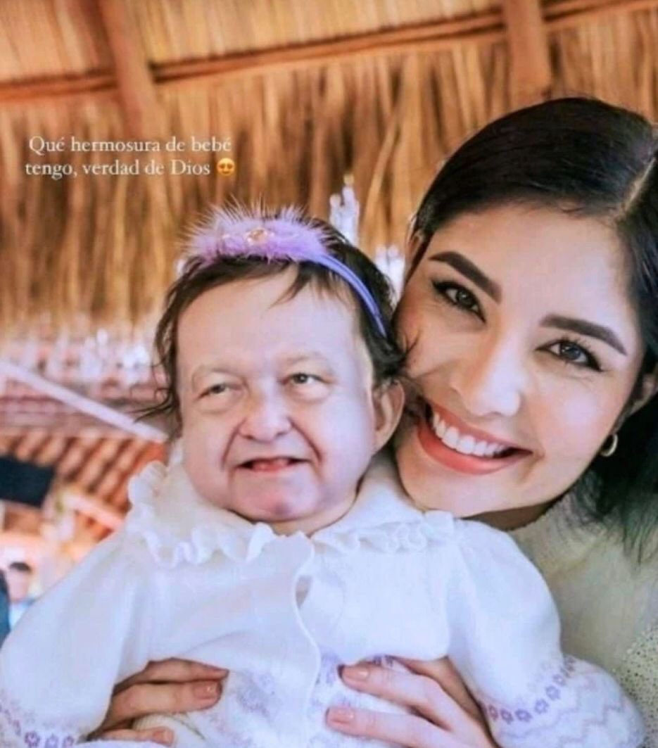 ImpudorPolitico's tweet photo. A propósito, Betty la fea, digo la Zopi ya habrá visto que la niña de Geraldine de Nayarit se parece muchísimo al miserable cobarde corrupto mentiroso cínico hipócrita resentido y vengativo presidente López Obrador. 😩

Ccp para los miserables chairos pendejos 

Disfruten👇😂🤣😂 https://t.co/dEdMms5WAz
