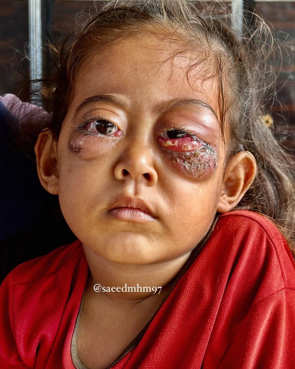 Lütfen Gazze'yi unutma unutturma