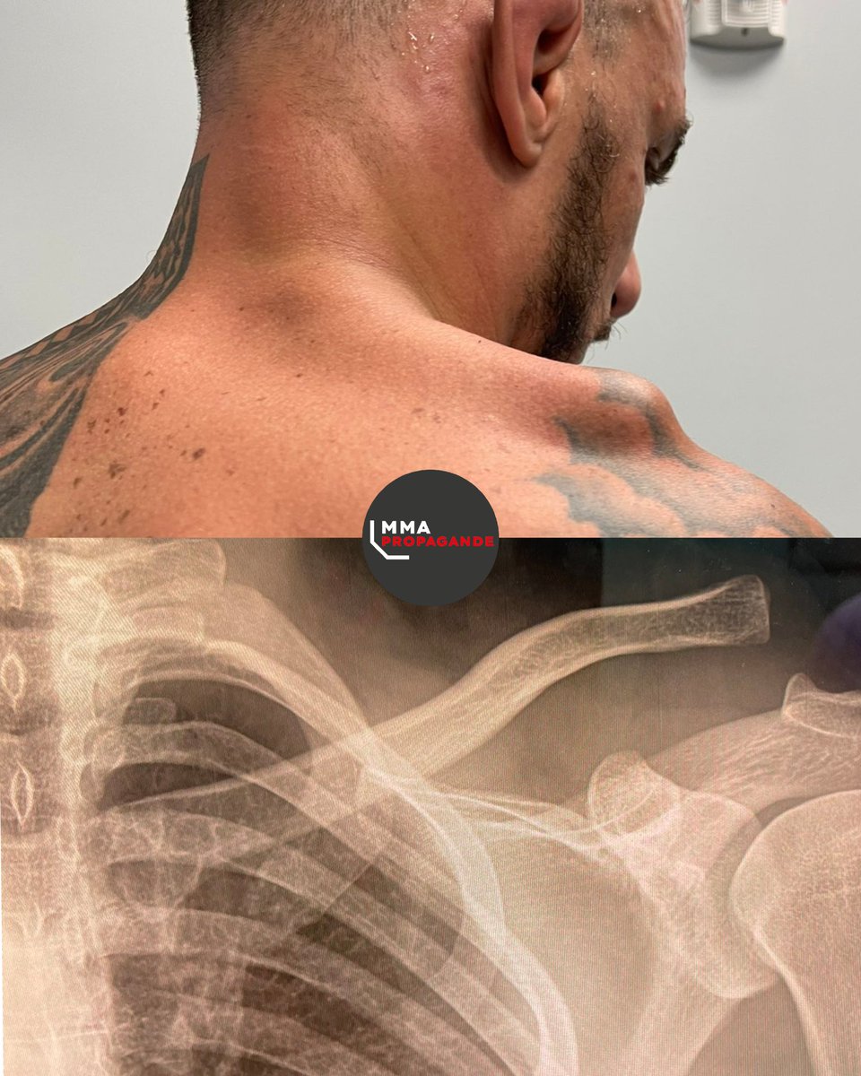 MMAPropagande's tweet photo. 🇧🇷 Renato Moicano a combattu notre 🇨🇵 Benoît Saint-Denis avec une grave blessure survenue il y a 3 semaines. BIG RESPECT pour ne pas s'être retiré du combat et surtout pour la performance. #UFCParis https://t.co/ll1AjZzQ9y