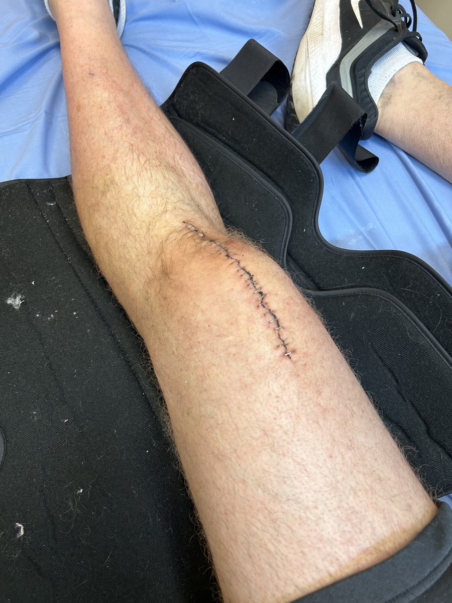 If you're looking for a lighthearted read.

medium.com/@ianmitchellgi…