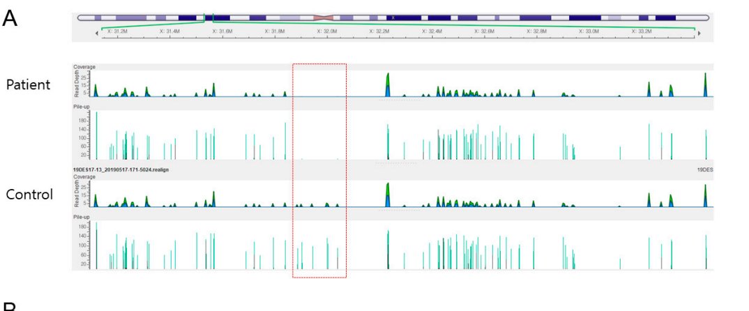 nikakhtar_ali's tweet photo. Diagnosis of Duchenne Muscular Dystrophy in a Presymptomatic Infant Using Next-Generation Sequencing and Chromosomal Microarray Analysis: A Case Report
👉 https://t.co/KuJg0obRX3
#DuchenneMuscularDystrophy #GeneticTesting #EarlyDiagnosis #NextGenerationSequencing #CreatineKinase https://t.co/waHHbY0hL0