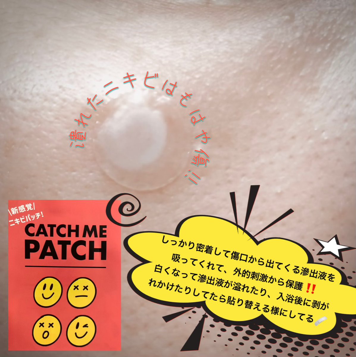 cosmecosme29's tweet photo. #PR どんだけ好きなんだよってくらい本当にお気に入りのニキビパッチなの‼️
何度も紹介するくらい欠かせない✨

キャッチミーパッチのニキビパ��チ‼️

世の中に沢山あるパッチだけど、コレほんとにグッドデザインみぃすけ賞🏆

#キャッチミーパッチ #ニキビパッチ }おすすめニキビケア https://t.co/0qt5NcTZz9