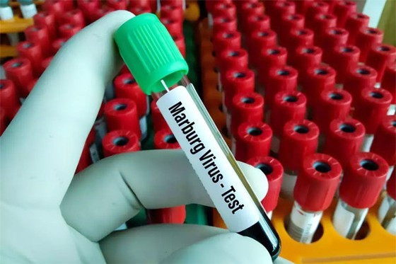 Salvus24_'s tweet photo. 🔴 Marburg Virus Detected in Rwanda 🇷🇼
1-Protect yourself &amp; your community:
2-Avoid contact with infected individuals
3-Wash hands regularly
4-Stay away from wild animals
Follow safe burial practices
Listen to @RwandaHealth for updates
Together, we can stop the spread.
 #Salvus24 https://t.co/7lLwgumYxG