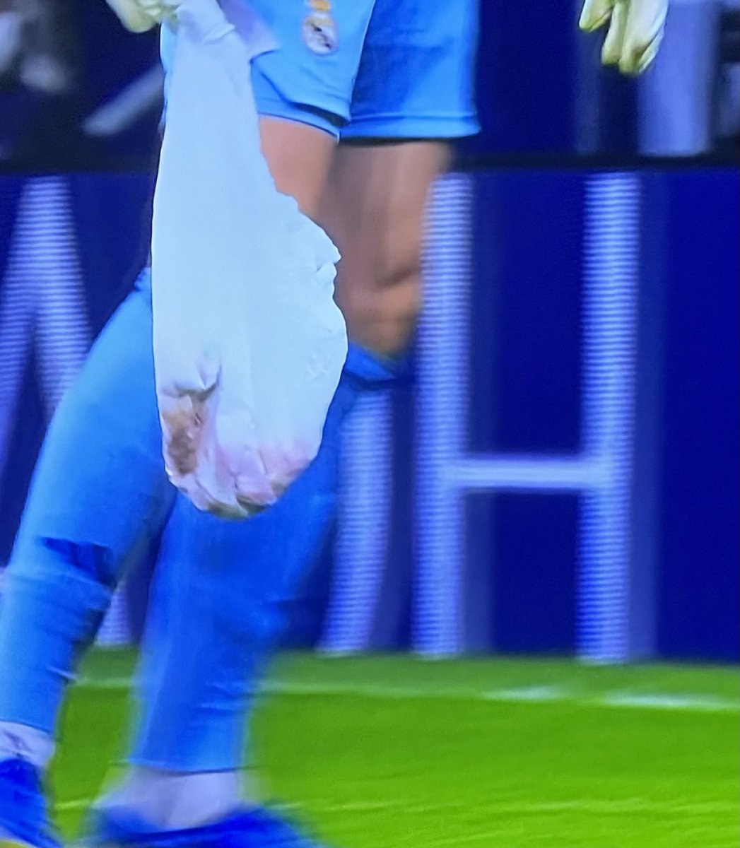 theMadridZone's tweet image. Threw garbarges at his plaque, whistled &amp;amp; insulted him during warm-up and throughout all the game.

But, when Courtois celebrates infront of them, that's where they draw the line &amp;amp; start throwing objects on the pitch trying to harm him.

Atletico Madrid fans for you, awful!