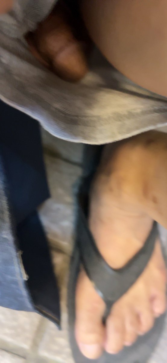 zhngnindsh17's tweet photo. 沒穿內褲蹲著時就是如此後果⋯⋯🤣🤣🤣但騎車時確是超～涼的🤣🤣🤣昨晚好像真的感冒😷了😵‍💫懶懶的😵‍💫 https://t.co/9F2Kzf33Jh