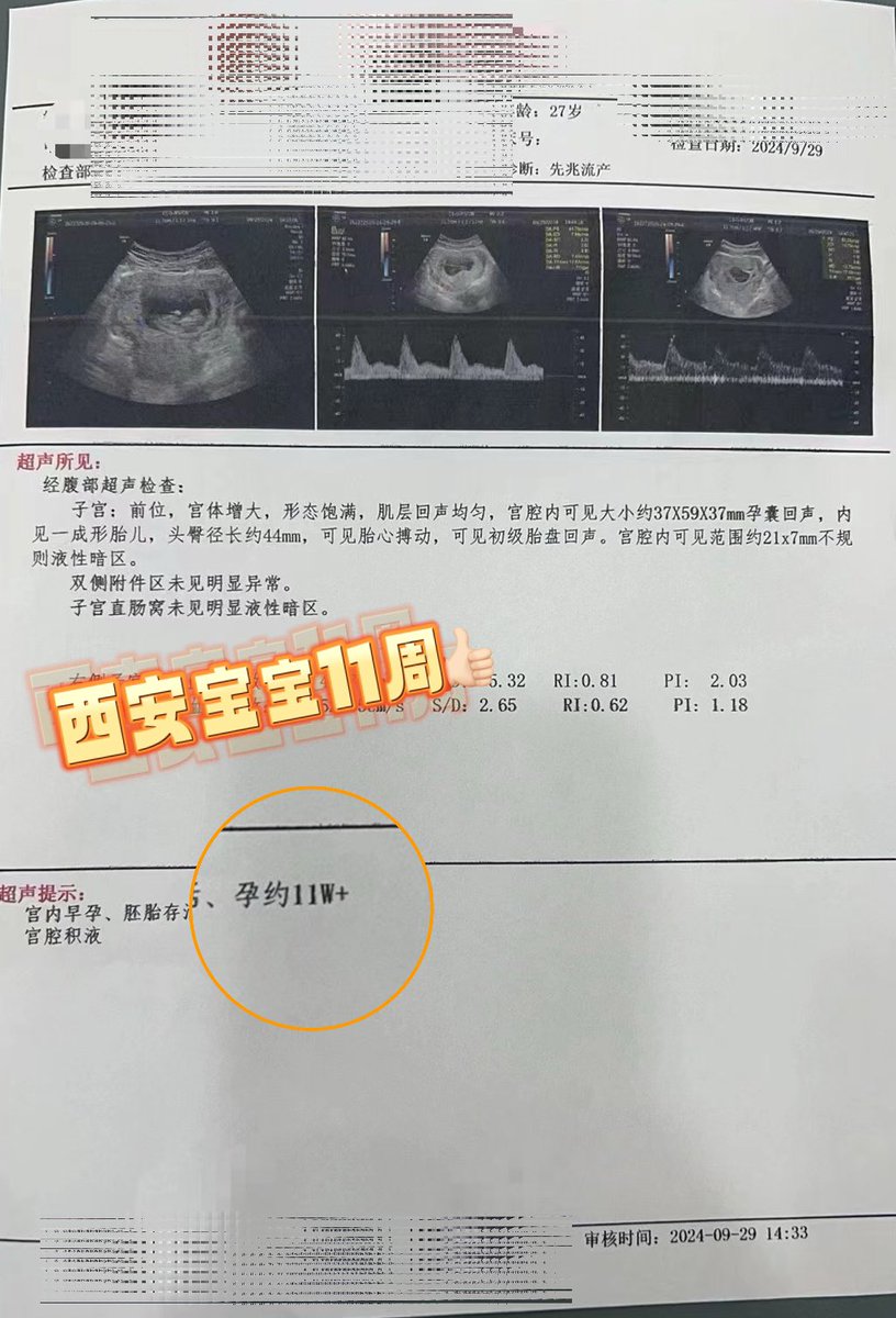 ivan611504141's tweet photo. #9月持续传递好孕🤰🏻今日产检👇🏻
每一份产检报告，不只是我们完成的一份工作，更是守护着一个个家庭的希望。
#代孕 #泰完美 #同性 #男男 #夫夫  #LGBTQ #gay https://t.co/CT0gMVQBCW