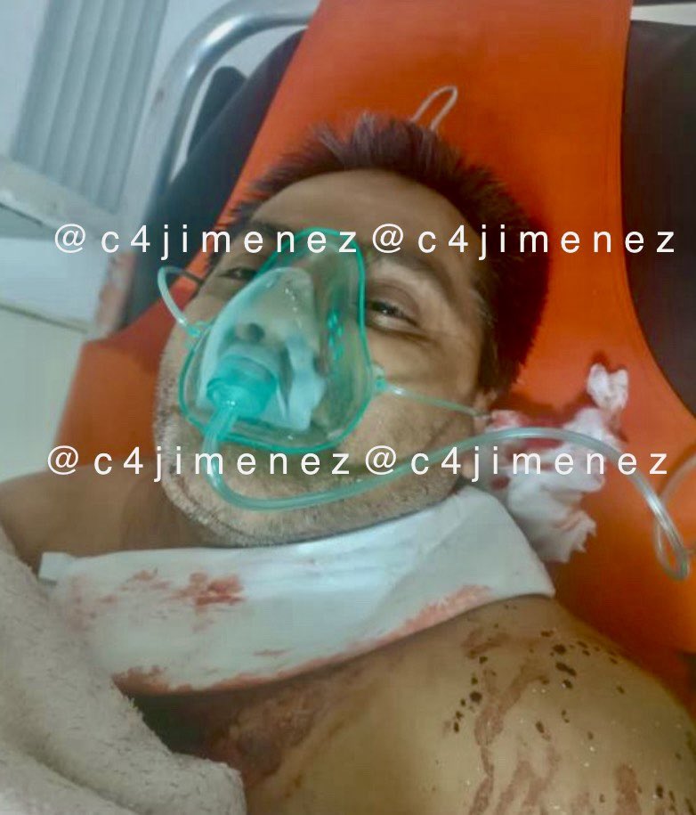 INFELIZ!
LO DESCUBREN VIOLANDO a SU NIETA… e INTENTA SUICIDARSE ANTES de SER DETENIDO
Edwin Velasco
Agredió a su nieta de 7 años en su casa d <a href="/Alcaldia_Coy/">Alcaldía de Coyoacán</a>
Su hija, q es mamá d la niña, lo descubrió y llamó a <a href="/SSC_CDMX/">SSC CDMX</a>
Al verse rodeado, tomó una navaja y se cortó el cuello.