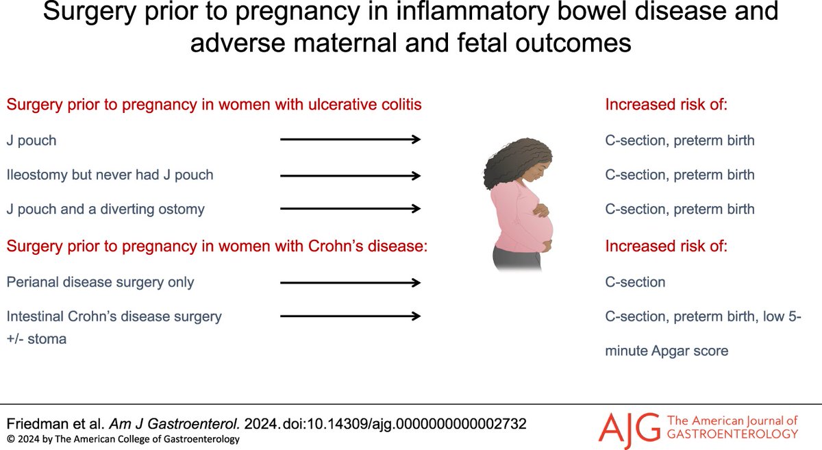 AJG - The American Journal of Gastroenterology (@amjgastro) on Twitter photo In the 📕#RedJournal:
Does Surgery Before Pregnancy in Women With Inflammatory Bowel Disease Increase the Risk of Adverse Maternal and Fetal Outcomes? A Danish National Cohort Study
Friedman, et al.
👉 bit.ly/4dwCyU0
<a href="/sonia_friedman/">Sonia Friedman</a> <a href="/mertz_n/">Bente Mertz Nørgård</a> In the 📕#RedJournal:
Does Surgery Before Pregnancy in Women With Inflammatory Bowel Disease Increase the Risk of Adverse Maternal and Fetal Outcomes? A Danish National Cohort Study
Friedman, et al.
👉 bit.ly/4dwCyU0
<a href="/sonia_friedman/">Sonia Friedman</a> <a href="/mertz_n/">Bente Mertz Nørgård</a>