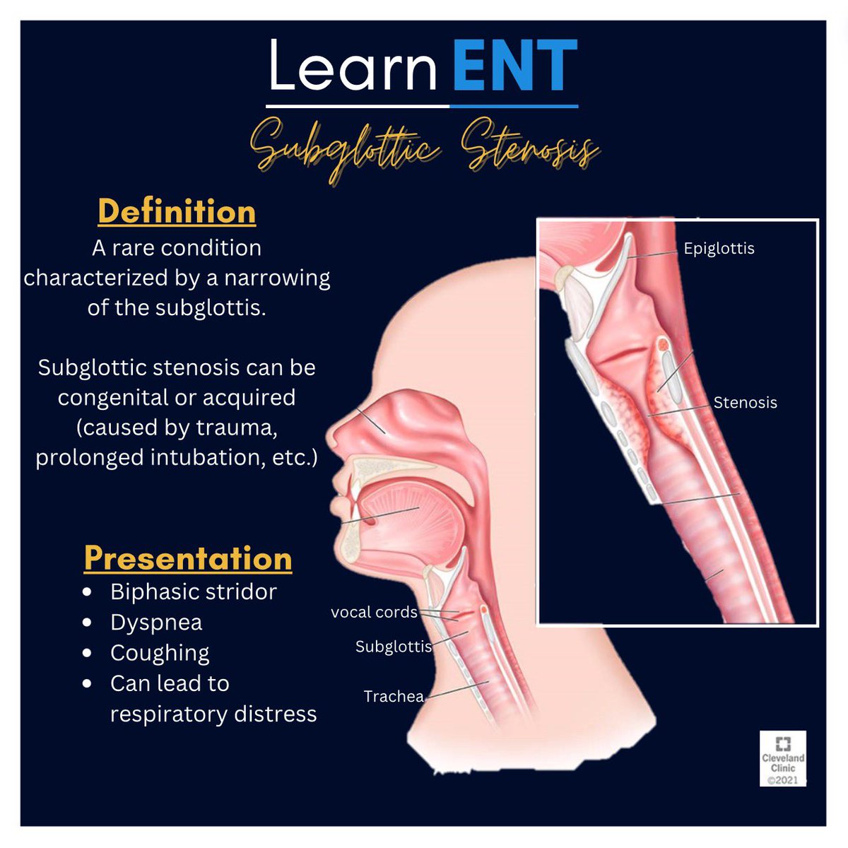 LearnENT's tweet photo. Breathe easy? Not always. Learn about subglottic stenosis🔍 https://t.co/3hpS5v1qDT
