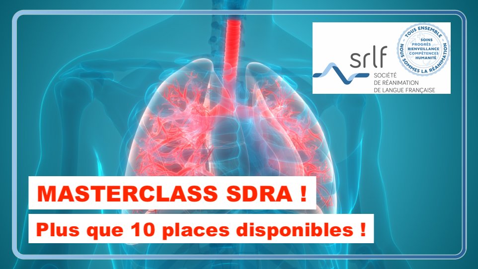 La prochaine Masterclass, consacrée au SDRA, se tiendra les du 12 et 13 décembre 2024, à la SLRF à Paris.
Une Masterclass... bientôt complète !  Venez vite vous inscrire ! 

Programme et inscription : zurl.co/CzYU 
#SRLF #SDRA