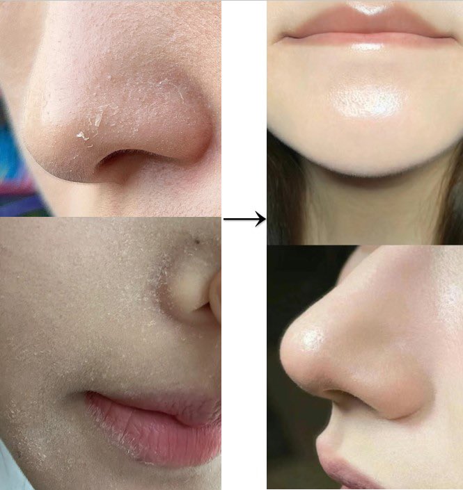 まさこ tweet media