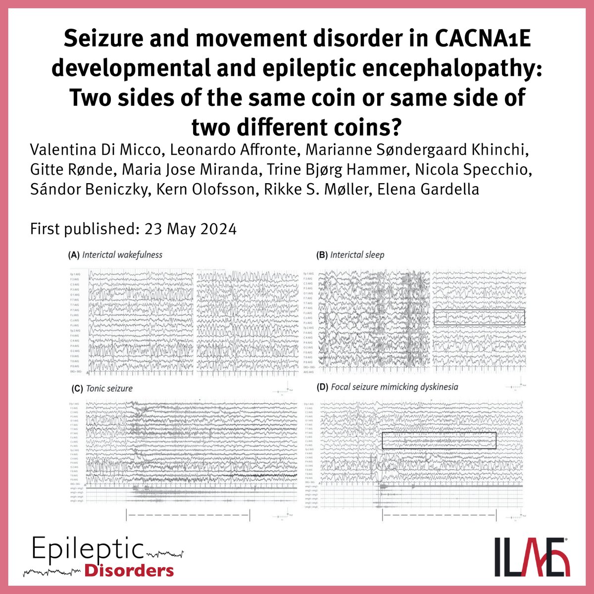 International League Against Epilepsy (@ilaeweb) on Twitter photo Key point: "CACNA1E variant p.(Gly352Arg) is associated with early-onset DEE, dystonia/dyskinesia and contractures."
<a href="/EpiDisorders/">Epileptic Disorders</a>: doi.org/10.1002/epd2.2⦠Key point: "CACNA1E variant p.(Gly352Arg) is associated with early-onset DEE, dystonia/dyskinesia and contractures."
<a href="/EpiDisorders/">Epileptic Disorders</a>: doi.org/10.1002/epd2.2ā¦
