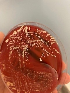 NUH Pathogen Bank (@pathogenbank) on Twitter photo I grow slowly in aerobic conditions and can be seen as fine, branching, beaded GPB on a Gram stain. I am partially acid-fast when a modified Ziehl-Neelsen is applied. I classically cause respiratory infections and brain abscesses. What am I? I grow slowly in aerobic conditions and can be seen as fine, branching, beaded GPB on a Gram stain. I am partially acid-fast when a modified Ziehl-Neelsen is applied. I classically cause respiratory infections and brain abscesses. What am I?