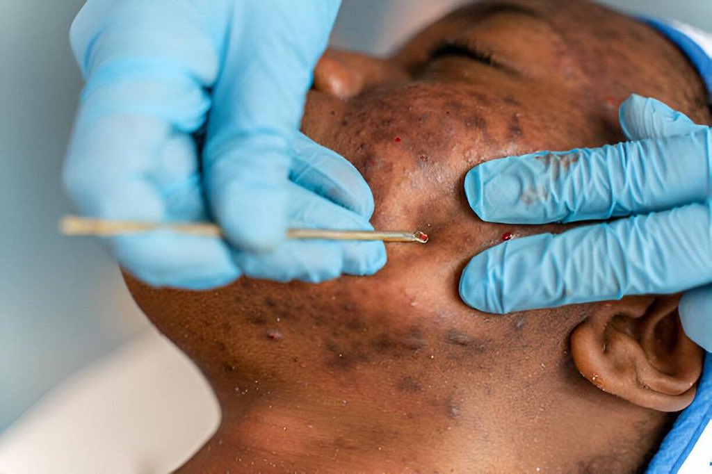 VerbenaWellness's tweet photo. Struggling with skincare concerns? We’ve got you covered! From pesky acne to stubborn dark spots, there is a solution for every problem at Verbena Wellness Clinic.

Let’s tackle those skin care woes together!
#SkinCareTip #VerbenaWellnessClinic https://t.co/PxfZsI8WUQ