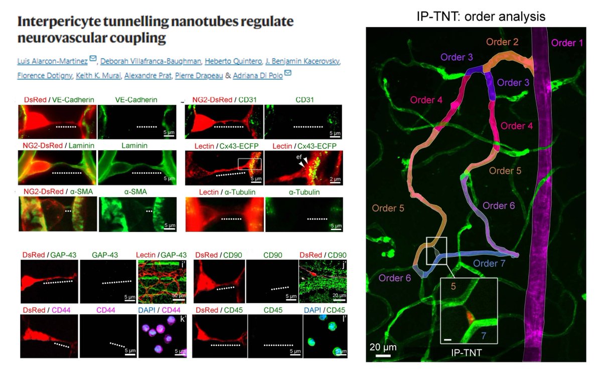 In vivo evidence for the functionality of #Pericyte #TunnelingNanoTube in Retina😎

Inter-pericytic TNT connects capillaries of the same or different orders

Transfer Ca2+ signals &amp; Mitochondria

Disrupted by ischemia (retinal central artery ligation, focal photothrombosis, OGD)