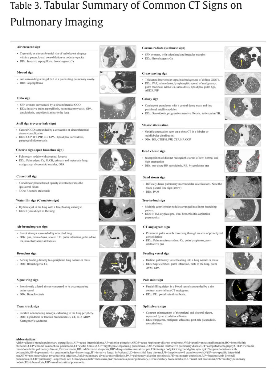 Summary of Common CT Signs on Pulmonary Imaging