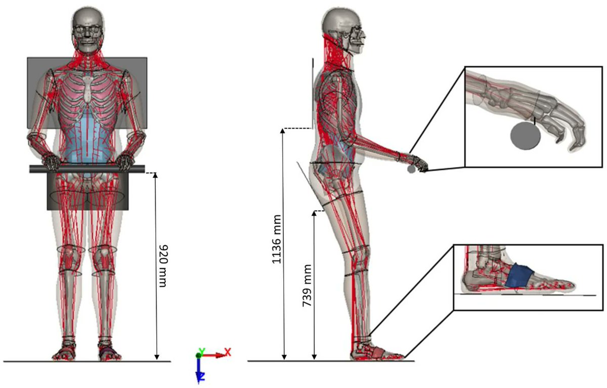 ABME (@abmejournal) on Twitter photo Injury Risk Predictions in Lunar Terrain Vehicle (LTV) Extravehicular Activities (EVAs): A Pilot Study <a href="/wakeforestmed/">Wake Forest University School of Medicine</a> <a href="/WakeBME/">Wake Forest Biomedical Engineering</a> <a href="/ScottGayzik/">Francis Scott Gayzik</a> <a href="/jstitzel/">joel stitzel</a> <a href="/AshleyAWeaver/">Ashley A. Weaver, PhD</a> <a href="/luis_pov4/">Luis Poveda</a> <a href="/MiteshLalwala/">Mitesh Lalwala</a> <a href="/KaranDevane/">Karan Devane</a> <a href="/BMESociety/">Biomedical Engineering Society</a> <a href="/SpringerNature/">Springer Nature</a>
Link: rdcu.be/dVy1r Injury Risk Predictions in Lunar Terrain Vehicle (LTV) Extravehicular Activities (EVAs): A Pilot Study <a href="/wakeforestmed/">Wake Forest University School of Medicine</a> <a href="/WakeBME/">Wake Forest Biomedical Engineering</a> <a href="/ScottGayzik/">Francis Scott Gayzik</a> <a href="/jstitzel/">joel stitzel</a> <a href="/AshleyAWeaver/">Ashley A. Weaver, PhD</a> <a href="/luis_pov4/">Luis Poveda</a> <a href="/MiteshLalwala/">Mitesh Lalwala</a> <a href="/KaranDevane/">Karan Devane</a> <a href="/BMESociety/">Biomedical Engineering Society</a> <a href="/SpringerNature/">Springer Nature</a>
Link: rdcu.be/dVy1r