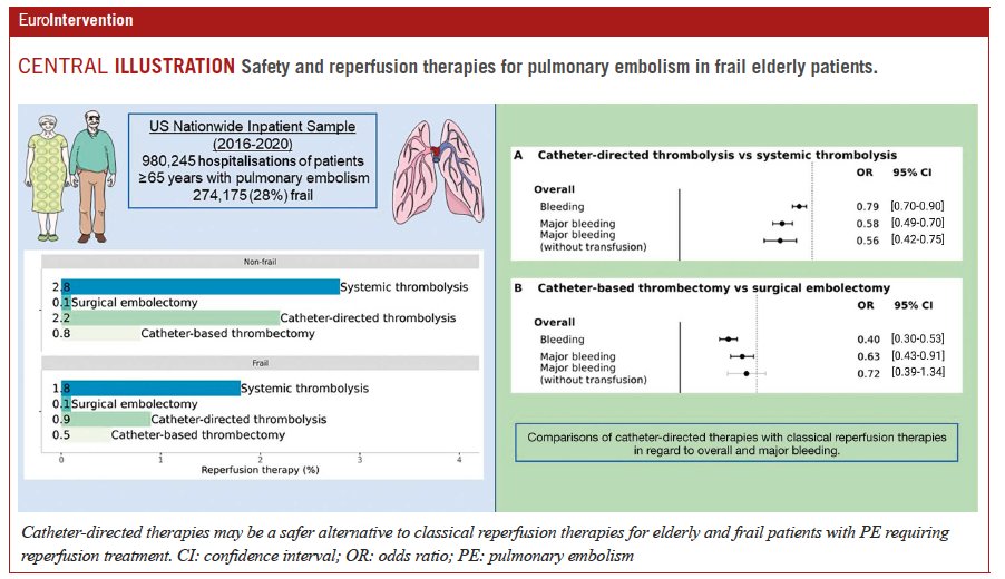 In elderly and frail patients with pulmonary embolism, the current use of classical reperfusion treatments (ST or SE) is low. The use of CDT is emerging as a promising and safe alternative for this vulnerable patient population. #EAPCI ow.ly/bQM450PSSJI