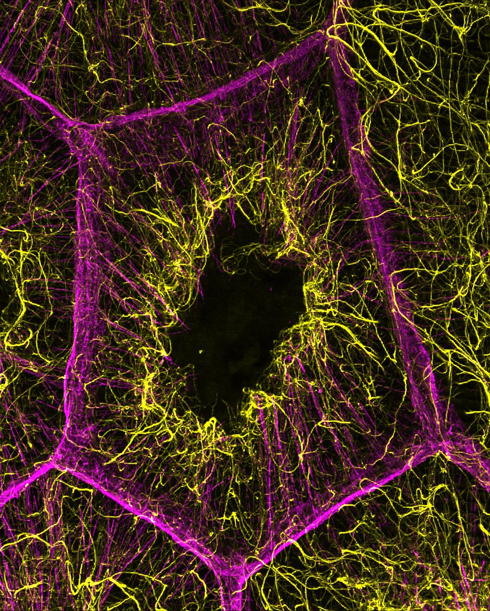 FocalPlane (@focalplane_jcs) on Twitter photo 📢Voting in the #JCSImagingSI cover competition is open. We'll be highlighting all the shortlisted images this week!
Vote number 9 for ‘Intricate Interactions: The Dance of Microtubules and Actin’ from Wen Lu (<a href="/volodya_gelfand/">Vladimir Gelfand</a> lab).
focalplane.biologists.com/2024/09/25/vot… 📢Voting in the #JCSImagingSI cover competition is open. We'll be highlighting all the shortlisted images this week!
Vote number 9 for ‘Intricate Interactions: The Dance of Microtubules and Actin’ from Wen Lu (<a href="/volodya_gelfand/">Vladimir Gelfand</a> lab).
focalplane.biologists.com/2024/09/25/vot…