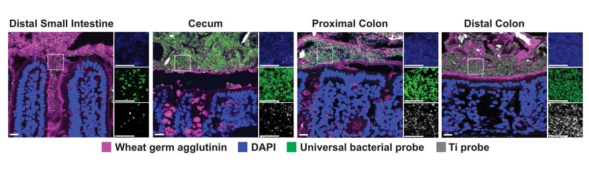 Samuel Hume (@drsamuelbhume) on Twitter photo 10. A new bacterium: Tomasiella immunophila (Ti)
It's found in the colon of mice, and (similar to some other bacteria, like Neisseria gonorrhoeae) secretes enzymes to degrade IgA in the gut - causing immune deficiency to promote infection
science.org/doi/10.1126/sc… 10. A new bacterium: Tomasiella immunophila (Ti)
It's found in the colon of mice, and (similar to some other bacteria, like Neisseria gonorrhoeae) secretes enzymes to degrade IgA in the gut - causing immune deficiency to promote infection
science.org/doi/10.1126/sc…